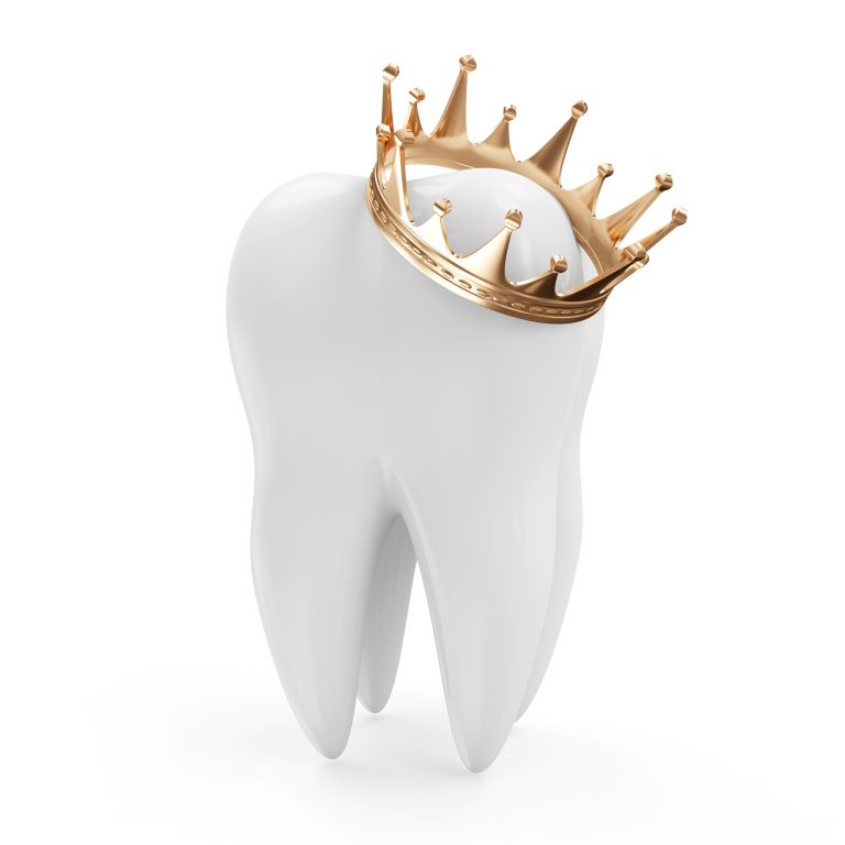 dental crown