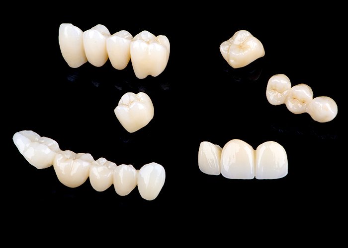 Dental-Crowns