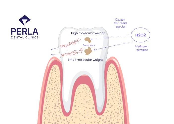 How Teeth Whitening Works