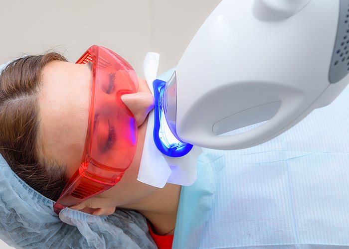 Use-of-Light-or-Laser-Activation