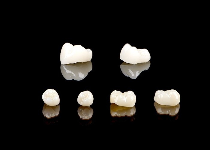 Zirconia-Crowns(1)