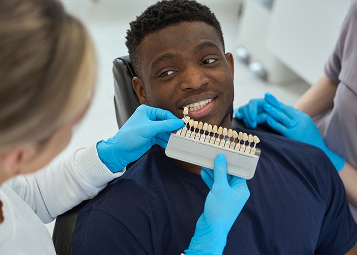 Composite-Bonding-Shade-Matching