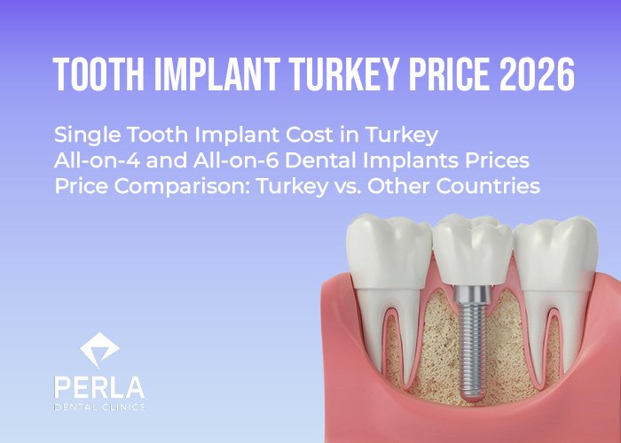 Zahnimplantat Türkei Preise 2026 Tooth Implant Turkey Price 2026