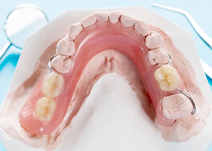Partial-dentures