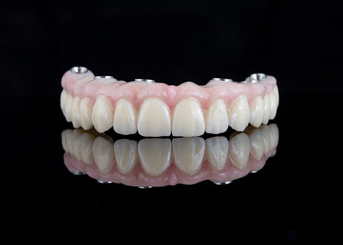 Snap-on-(overdentures)