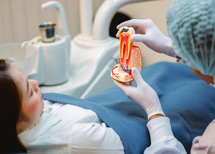 Cleaning and Shaping the Root Canals