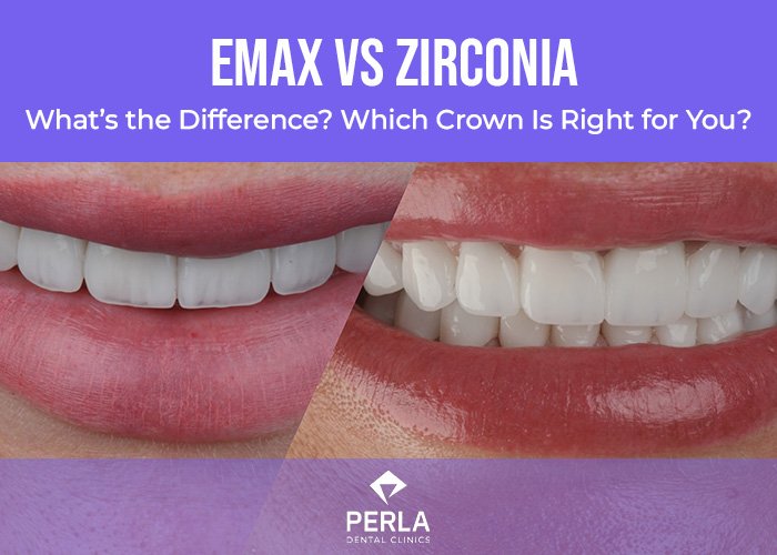 Emax vs Zirconia the Difference and Which Crown Is Right for You