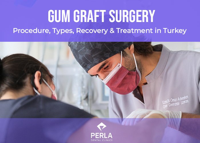 Gum Graft Surgery Procedure, Types, Recovery, Treatment in Turkey