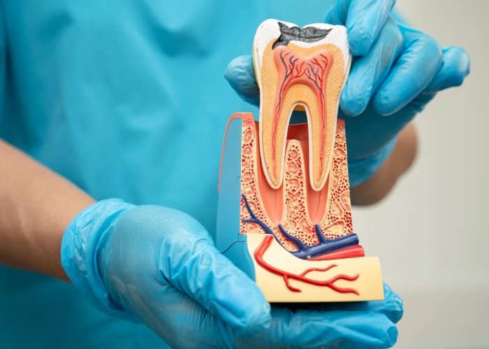 When Is a Root Canal Worth It