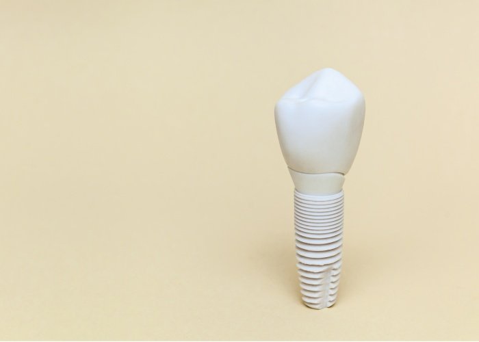 Zirconia dental implants