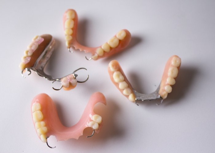 Partial Dentures