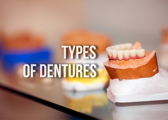 Types of Dentures Differences Materials Alternatives