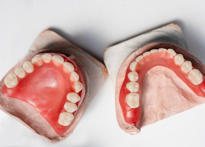 Upper and Lower Dentures