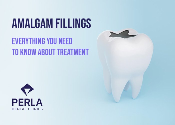 Amalgam Fillings Everything You Need to Know About Treatment