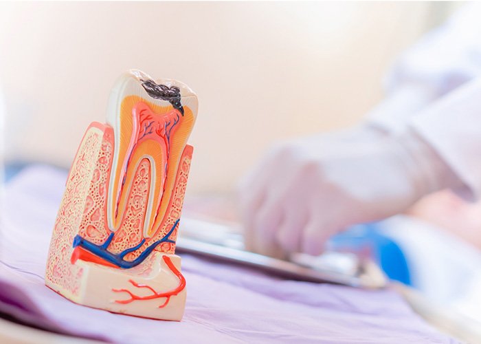 Amalgam Fillings: Everything You Need to Know About Treatment Are Amalgam Fillings Safe