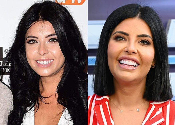 Cara De La Hoyde Turkey Teeth