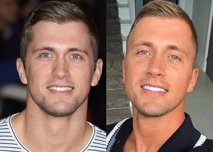 Dan Osborne Turkey Teeth