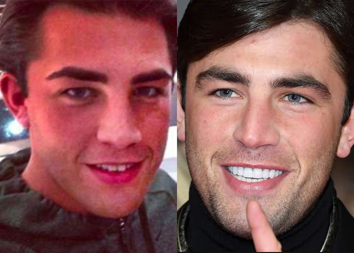 Jack Fincham Turkey Teeth