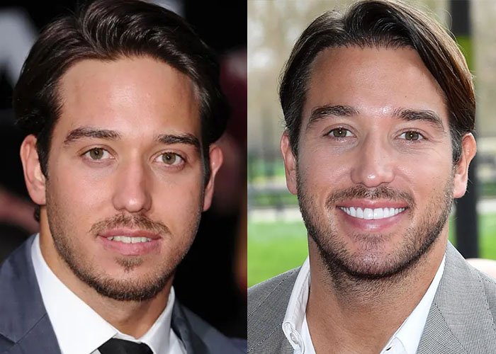 James Lock Turkey Teeth