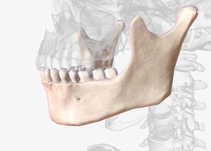 Jaw Surgery