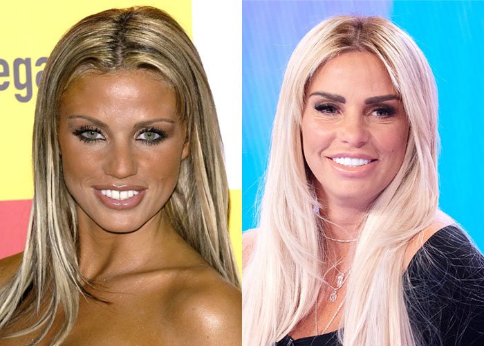 Katie Price Turkey Smile