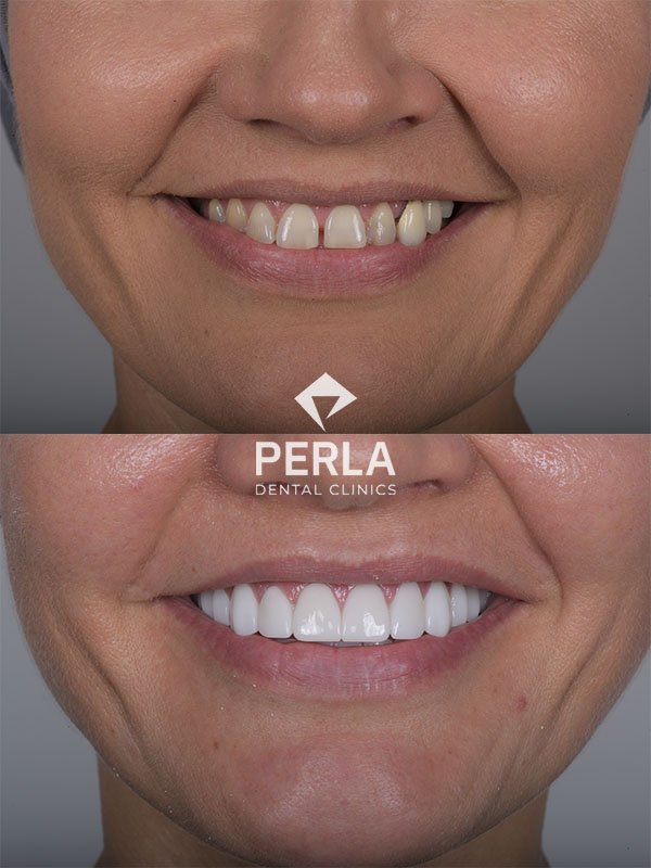 Oral and Maxillofacial Surgery Perla Dental Clinics Antalya