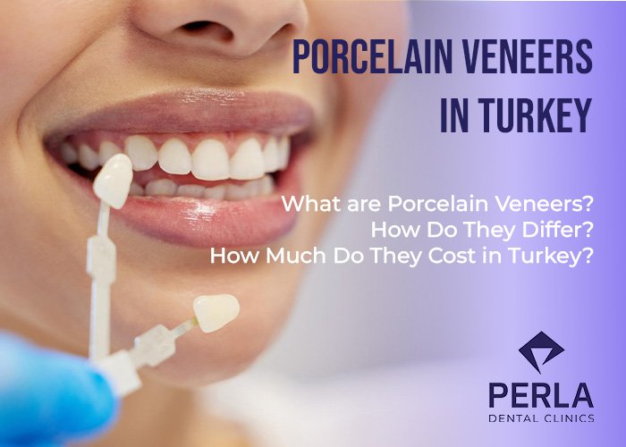 Porcelain Veneers in Turkey Cost