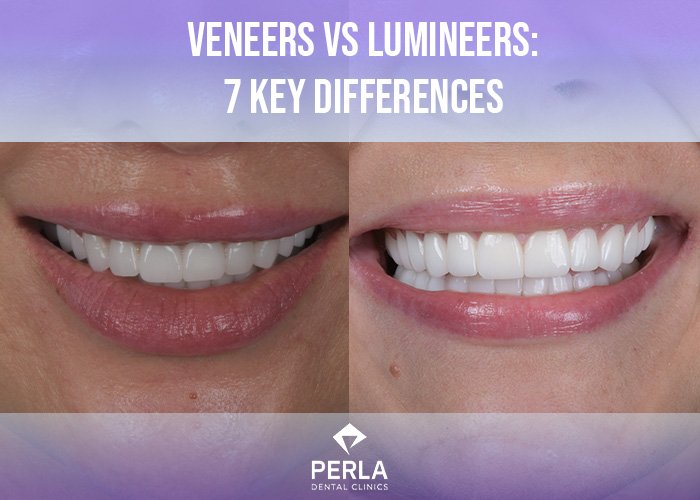 Veneers vs Lumineers 7 Key Differences Perla Dental Clinics