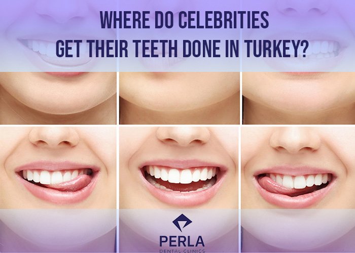 Dental Implants in Turkey: Prices, Packages and Procedures Where Do Celebrities Get Their Teeth Done in Turkey 2026 Guide