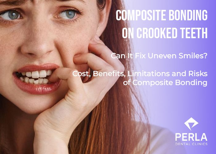 Composite Bonding on Crooked Teeth