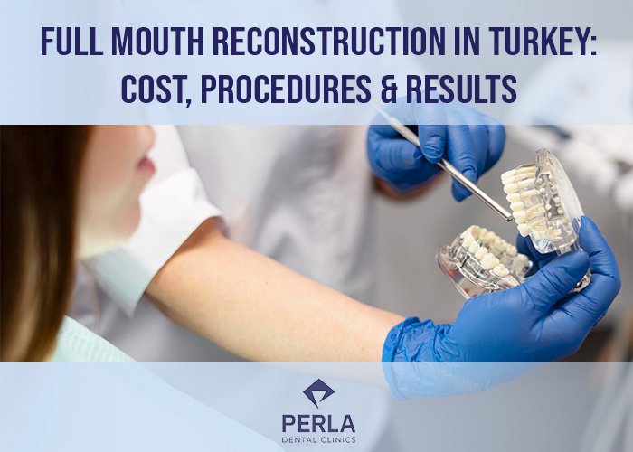 Full Mouth Reconstruction in Turkey Cost, Procedures & Results