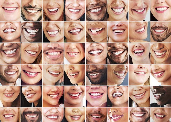How to Choose the Ideal Tooth Shade for You