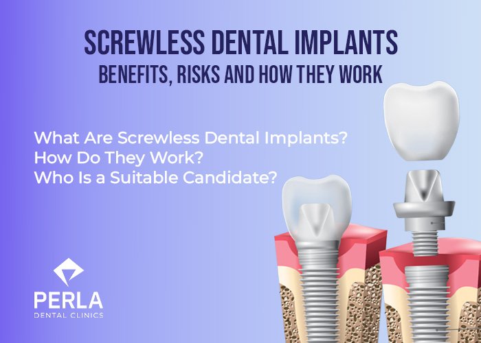 Screwless Dental Implants Benefits, Risks and How They Work