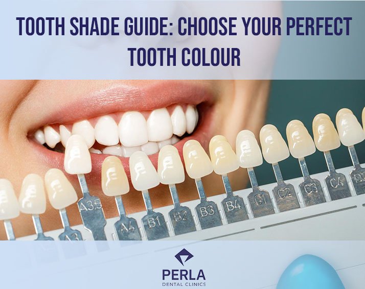 Tooth Shade Guide Choose Your Perfect Tooth Colour