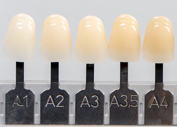 Tooth Shade Guide VITA Classical Group A