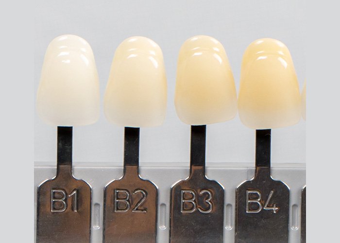 Tooth Shade Guide VITA Classical Group B