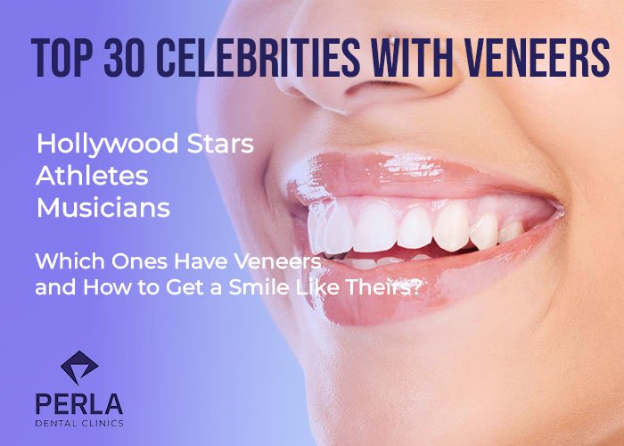 Top 30 Celebrities with Veneers