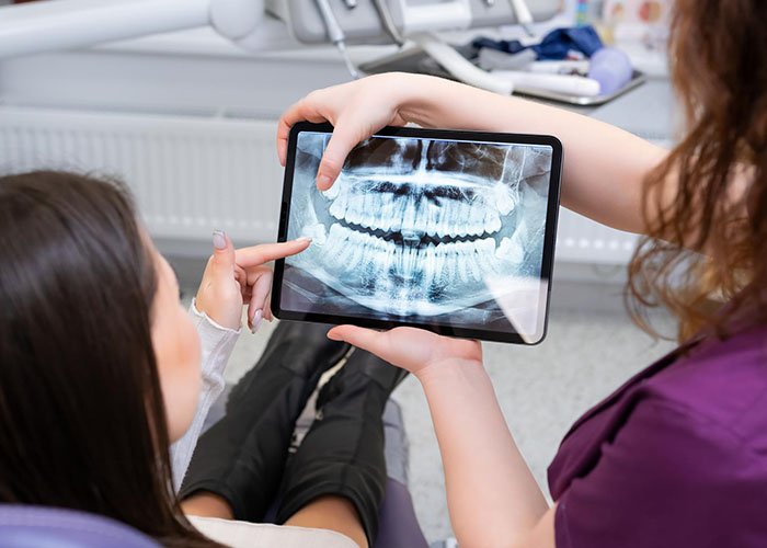 What to Ask Your Dentist or Oral Surgeon Before and After Removal