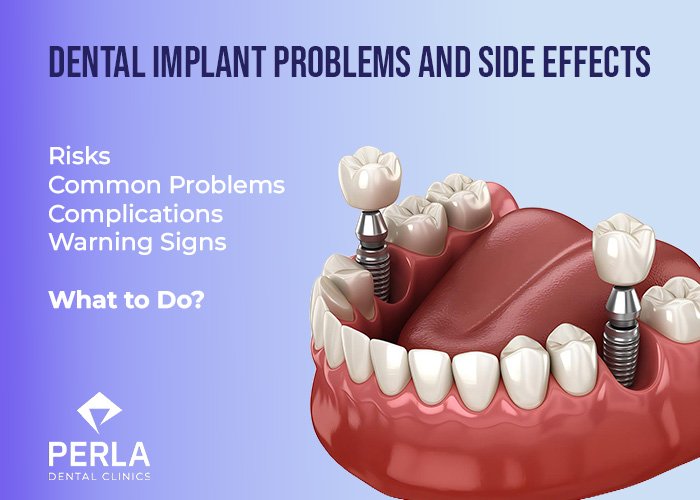 Dental Implant Problems and Side Effects: Risks, Warning Signs and What to Do Dental Implant Problems and Side Effects Risks, Warning Signs and What to Do