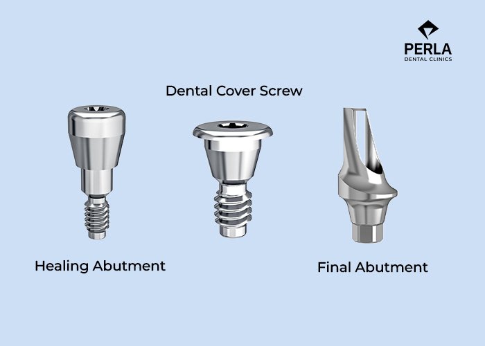 Healing Abutment vs Cover Screw vs Final Abutment