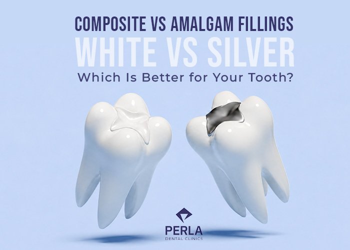Composite vs Amalgam Fillings Which Is Better for Your Teeth