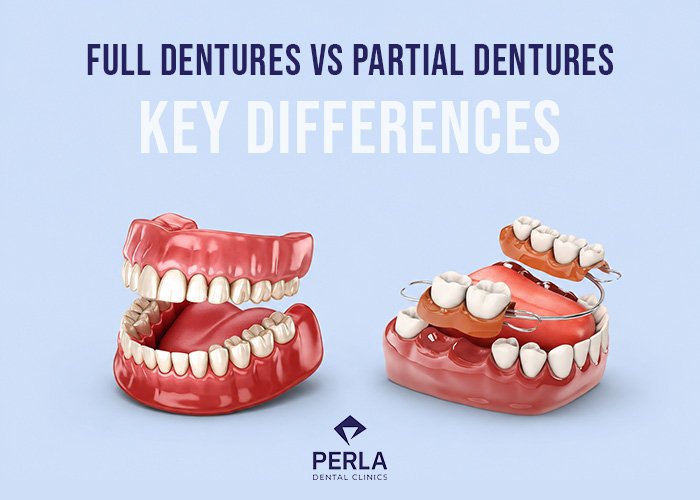 Full Dentures vs Partial Dentures Full Dentures vs Partial Dentures