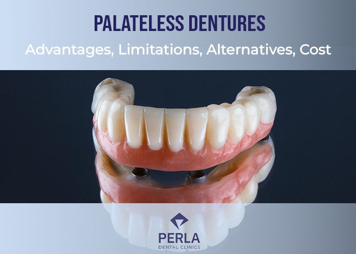 Palateless Dentures Advantages, Limitations, Alternatives, Cost