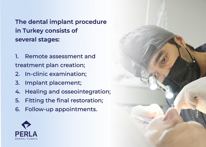 What Happens During Dental Implant Treatment