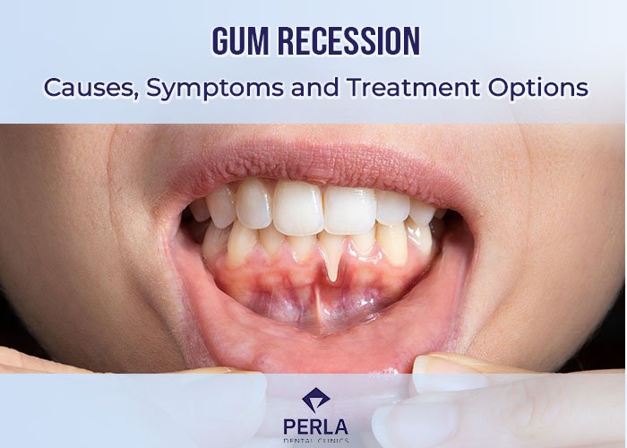 Gum Recession: Causes, Symptoms and Treatment Options Gum Recession Causes, Symptoms and Treatment Options