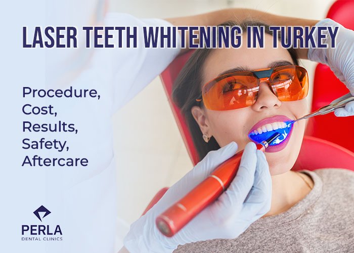 Laser Teeth Whitening in Turkey Procedure, Cost, Results Safety