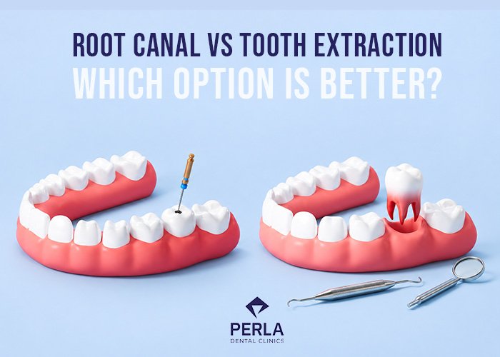 Root Canal vs Tooth Extraction Which Option Is Better