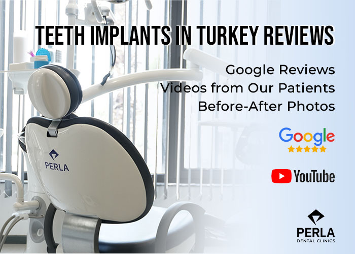 Dental Holiday in Antalya, Turkey: Prices & Packages for Dental Tourism Teeth Implants in Turkey Reviews Antalya