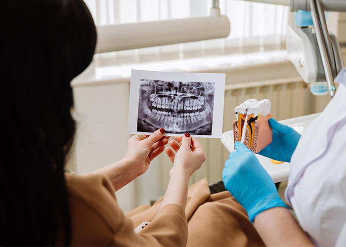 dental implant risks and complications